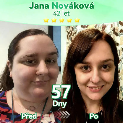 【𝑷𝒐𝒔𝒍𝒆𝒅𝒏í 𝒅𝒆𝒏 𝒂𝒌𝒄𝒆 – 𝒔𝒍𝒆𝒗𝒂 90 % 】🍋🍋𝑭𝒍𝒐𝒓𝒊𝒔𝒎𝒂® 𝑴𝒐𝒓𝒊𝒏𝒈𝒂 𝑿 𝑩𝒆𝒓𝒃𝒆𝒓𝒊𝒏 10-𝑰𝒏-1 𝑷𝒐𝒌𝒓𝒐č𝒊𝒍ý 𝑵𝒂𝒏𝒐 𝑴𝒊𝒌𝒓𝒐𝒋𝒆𝒉𝒍𝒚 𝑵á𝒑𝒍𝒂𝒔𝒕