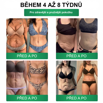 【𝑷𝒐𝒔𝒍𝒆𝒅𝒏í 𝒅𝒆𝒏 𝒂𝒌𝒄𝒆 – 𝒔𝒍𝒆𝒗𝒂 90 % 】🍋‍🟩🍋‍🟩𝑭𝒍𝒐𝒓𝒊𝒔𝒎𝒂® 𝑴𝒐𝒓𝒊𝒏𝒈𝒂 𝑿 𝑩𝒆𝒓𝒃𝒆𝒓𝒊𝒏 10-𝑰𝒏-1 𝑷𝒐𝒌𝒓𝒐č𝒊𝒍ý 𝑵𝒂𝒏𝒐 𝑴𝒊𝒌𝒓𝒐𝒋𝒆𝒉𝒍𝒚 𝑵á𝒑𝒍𝒂𝒔𝒕
